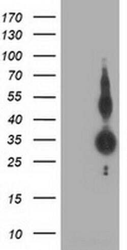 ZFP36 Monoclonal Antibody (OTI3C3), TrueMAB , OriGene 100 &mu;L; Unconjugated:Antibodies,