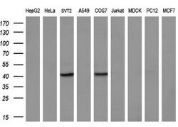ZFP36 Monoclonal Antibody (OTI5E3), TrueMAB , OriGene 30 &mu;L | Buy Online | Origene Technologies | Fisher Scientific