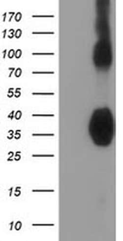 ZFP36 Monoclonal Antibody (OTI1F2), TrueMAB , OriGene 100 &mu;L; Unconjugated:Antibodies,