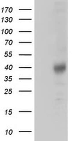 ZFP36 Mouse anti-Human, Clone: OTI1A2, liquid, TrueMAB 100 &mu;L; Unconjugated:Antibodies,