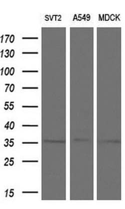 ZFP36 Mouse anti-Human, Clone: OTI1A2, liquid, TrueMAB 100 &mu;L; Unconjugated:Antibodies,