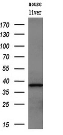 ZFP36 Mouse anti-Human, Clone: OTI1A2, liquid, TrueMAB 100 &mu;L; Unconjugated:Antibodies,