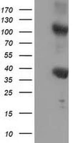 ZFP36 Monoclonal Antibody (OTI4E1), TrueMAB , OriGene:Antibodies:Primary