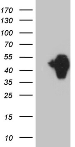 ZFP36L1 Mouse anti-Human, Clone: OTI4F8, lyophilized, TrueMAB 100 &mu;g | Buy Online | Origene Technologies | Fisher Scientific