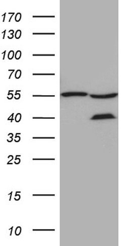 ZFYVE1 Mouse anti-Human, Clone: OTI4B3, lyophilized, TrueMAB 100 &mu;g;