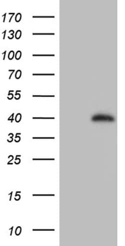 ZFYVE1 Monoclonal Antibody (OTI1A2), TrueMAB , OriGene 30 &mu;L; Unconjugated:Antibodies,