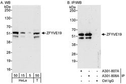 ZFYVE19 Rabbit anti-Human, Polyclonal, Bethyl Laboratories 100 &mu;L; Unconjugated:Antibodies,