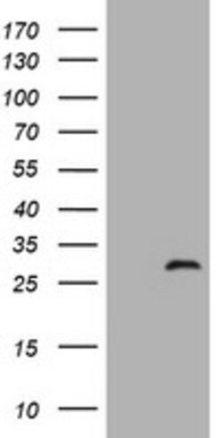 ZFYVE21 Mouse anti-Human, Clone: OTI4A2, lyophilized, TrueMAB 100 &mu;g;