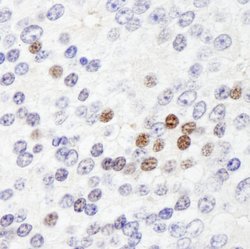 ZHX3 Polyclonal Antibody, Bethyl Laboratories:Antibodies:Primary Antibodies