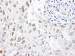 ZHX3 Polyclonal Antibody, Bethyl Laboratories 10 &mu;L; Unconjugated:Antibodies,