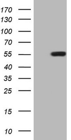 ZIC3 Mouse anti-Human, Clone: OTI6F7, lyophilized, TrueMAB 100 &mu;g; Unconjugated:Antibodies,