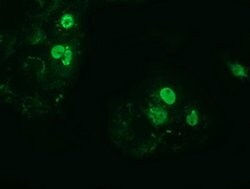 ZIM2 Monoclonal Antibody (OTI5E12), TrueMAB , OriGene 100 &mu;L; Unconjugated:Antibodies,