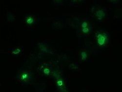 ZIM2 Monoclonal Antibody (OTI7G1), TrueMAB , OriGene:Antibodies:Primary
