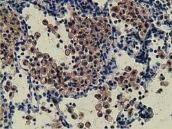 ZIM2 Monoclonal Antibody (OTI5E12), TrueMAB , OriGene 100 &mu;L; Unconjugated:Antibodies,