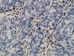 ZIM2 Monoclonal Antibody (OTI5E12), TrueMAB , OriGene 100 &mu;L; Unconjugated:Antibodies,