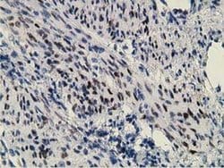 ZIM2 Monoclonal Antibody (OTI5E12), TrueMAB , OriGene 100 &mu;L; Unconjugated:Antibodies,
