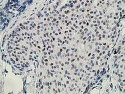ZIM2 Monoclonal Antibody (OTI5E12), TrueMAB , OriGene 100 &mu;L; Unconjugated:Antibodies,