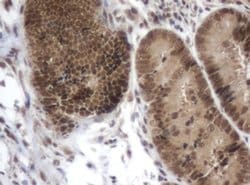 ZIM2 Monoclonal Antibody (OTI6D12), TrueMAB , OriGene 100 &mu;L; Unconjugated:Antibodies,