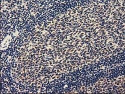 ZIM2 Monoclonal Antibody (OTI7G1), TrueMAB , OriGene:Antibodies:Primary