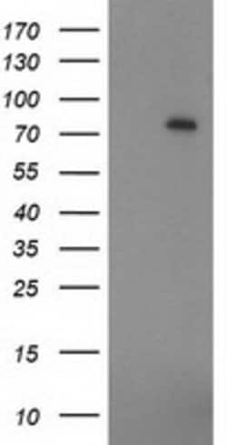 ZIM2 Mouse anti-Human, Clone: OTI5C7, lyophilized, TrueMAB 100 &mu;g; Unconjugated:Antibodies,