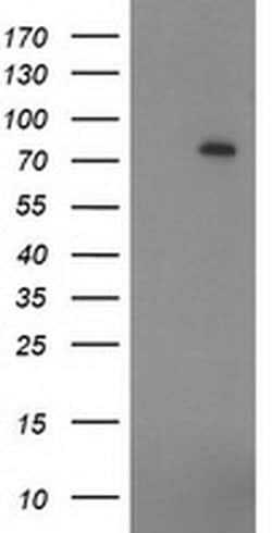 ZIM2 Monoclonal Antibody (OTI5C7), TrueMAB , OriGene 30 &mu;L; Unconjugated:Antibodies,