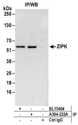 ZIPK Rabbit anti-Human, Polyclonal, Bethyl Laboratories 10 &mu;L; Unconjugated:Antibodies,