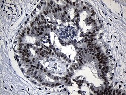ZKSCAN1 Monoclonal Antibody (OTI2C9), TrueMAB , OriGene 100 &mu;L; Unconjugated:Antibodies,