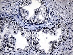ZKSCAN1 Monoclonal Antibody (OTI2C9), TrueMAB , OriGene 100 &mu;L; Unconjugated:Antibodies,