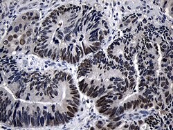 ZKSCAN1 Monoclonal Antibody (OTI2C9), TrueMAB , OriGene 100 &mu;L; Unconjugated:Antibodies,