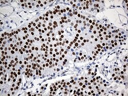 ZKSCAN1 Monoclonal Antibody (OTI3C4), TrueMAB , OriGene 30 &mu;L | Buy Online | Origene Technologies | Fisher Scientific