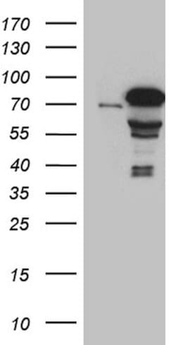 ZKSCAN1 Mouse anti-Human, Clone: OTI1E4, lyophilized, TrueMAB 100 &mu;g;