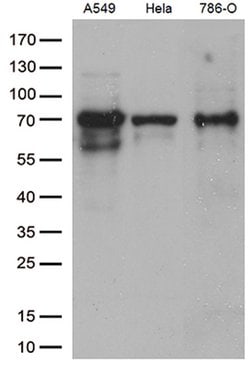 ZKSCAN1 Mouse anti-Human, Clone: OTI1E4, lyophilized, TrueMAB 100 &mu;g;