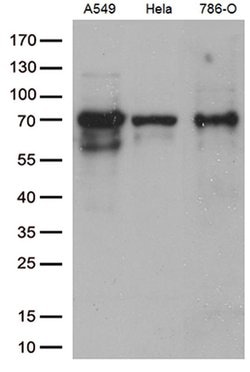 ZKSCAN1 Monoclonal Antibody (OTI1E4), TrueMAB , OriGene:Antibodies:Primary