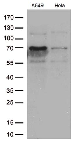 ZKSCAN1 Monoclonal Antibody (OTI2C9), TrueMAB , OriGene 100 &mu;L; Unconjugated:Antibodies,