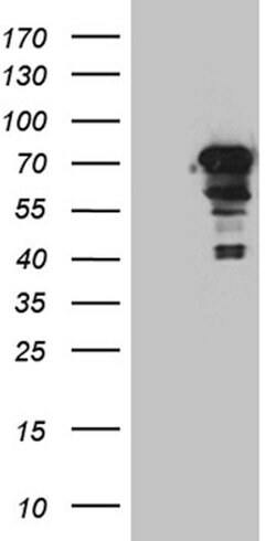 ZKSCAN1 Monoclonal Antibody (OTI3C4), TrueMAB , OriGene 30 &mu;L | Buy Online | Origene Technologies | Fisher Scientific