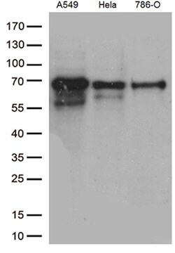 ZKSCAN1 Monoclonal Antibody (OTI3C4), TrueMAB , OriGene 30 &mu;L | Buy Online | Origene Technologies | Fisher Scientific