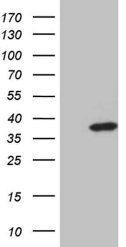 ZMAT4 Monoclonal Antibody (OTI9E11), TrueMAB , OriGene 30 &mu;L; Unconjugated:Antibodies,