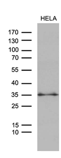 ZMAT4 Monoclonal Antibody (OTI9E11), TrueMAB , OriGene 30 &mu;L; Unconjugated:Antibodies,
