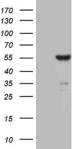 ZNF114 Mouse anti-Human, Clone: OTI6F4, lyophilized, TrueMAB 100 &mu;g;