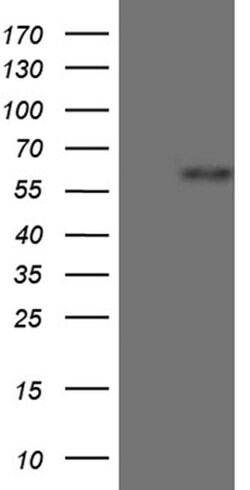 ZNF181 Monoclonal Antibody (OTI1E4), TrueMAB , OriGene 100 &mu;L; Unconjugated:Antibodies,