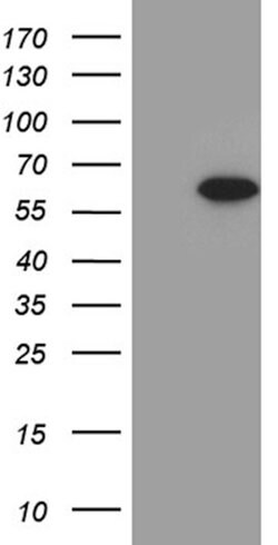 ZNF181 Mouse anti-Human, Clone: OTI9G2, lyophilized, TrueMAB 100 &mu;g;
