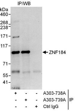 ZNF184 Rabbit anti-Human, Polyclonal, Bethyl Laboratories 100 &mu;L | Buy Online | Bethyl Laboratories, Inc | Fisher Scientific