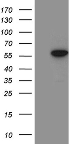 ZNF19 Mouse anti-Human, Clone: OTI10C3, lyophilized, TrueMAB 100 &mu;g;