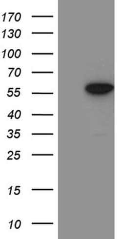 ZNF19 Monoclonal Antibody (OTI10C3), TrueMAB , OriGene 100 μL; Unconjugated:Antibodies,