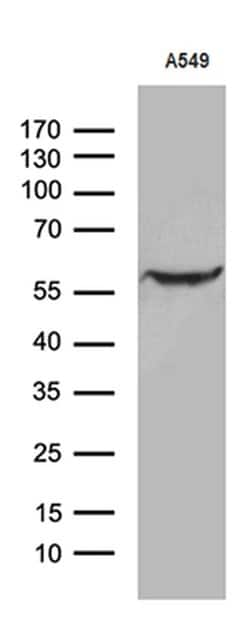 ZNF19 Monoclonal Antibody (OTI10C3), TrueMAB , OriGene 100 μL; Unconjugated:Antibodies,
