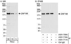 ZNF198 Rabbit anti-Human, Polyclonal, Bethyl Laboratories 100 &mu;L; Unconjugated:Antibodies,