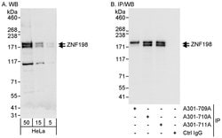 ZNF198 Rabbit anti-Human, Polyclonal, Bethyl Laboratories 100 &mu;L; Unconjugated:Antibodies,