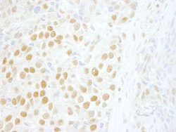 ZNF198 Polyclonal Antibody, Bethyl Laboratories 100 &mu;L; Unconjugated:Antibodies,