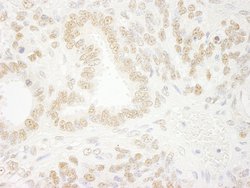 ZNF198 Polyclonal Antibody, Bethyl Laboratories 100 &mu;L; Unconjugated:Antibodies,