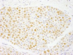 ZNF198 Polyclonal Antibody, Bethyl Laboratories:Antibodies:Primary Antibodies